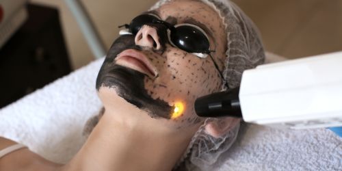 Close-up of a person's face receiving Glow Laser treatment at DermaGlow Esthetics.